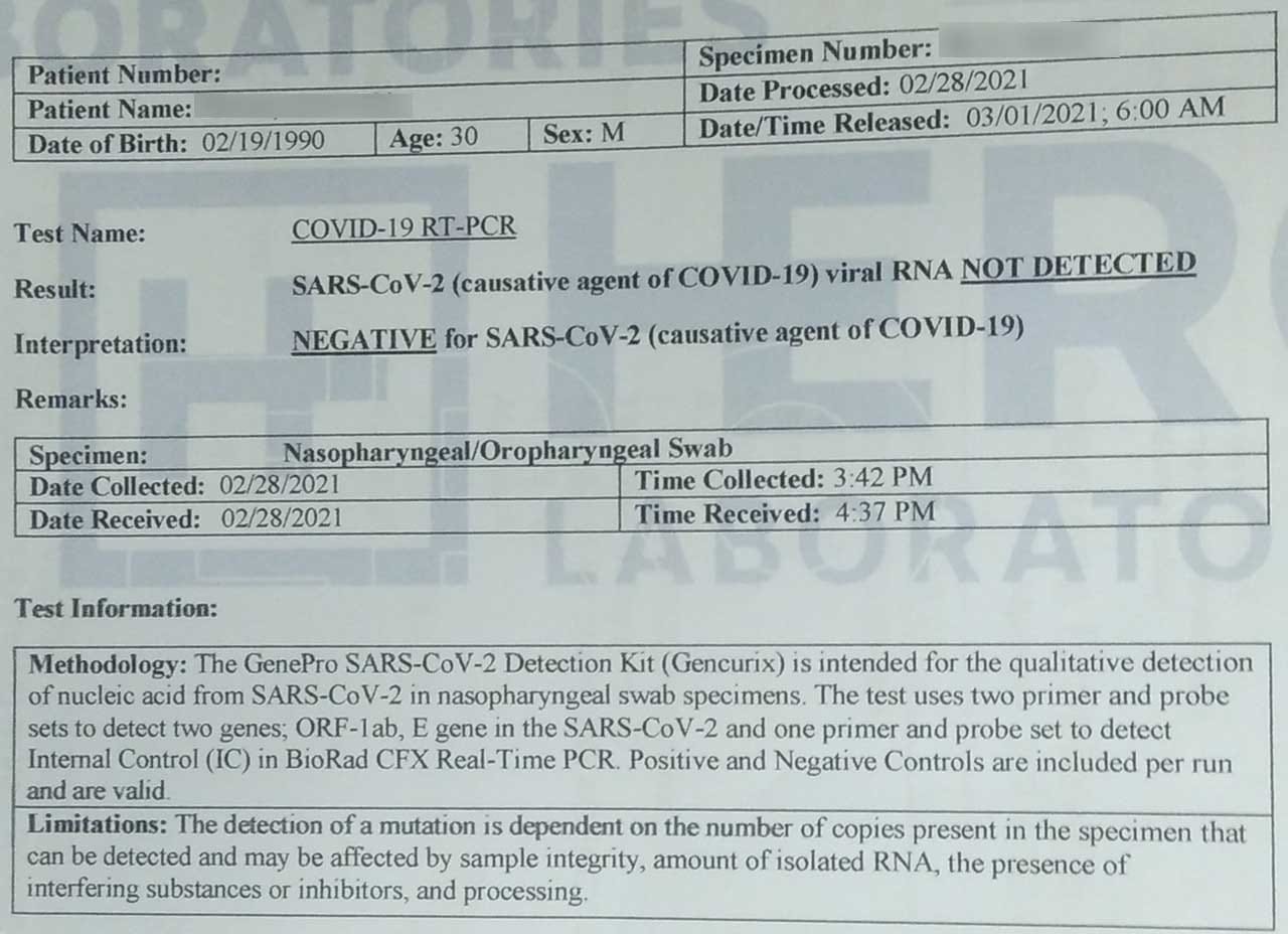 A Negative COVID19 test result using RT-PCR.